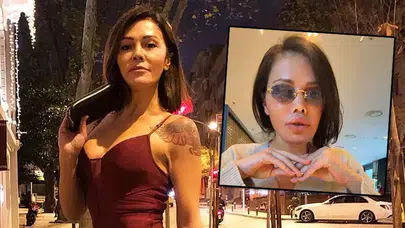 Didem Ceran estetikleri, neresinde ne estetiği var?