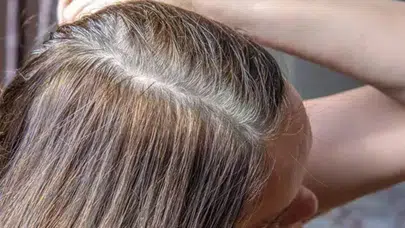 Kimyasal Boyaları Unutturan Yöntem! Beyaz Saçlar Böyle Kayboluyor