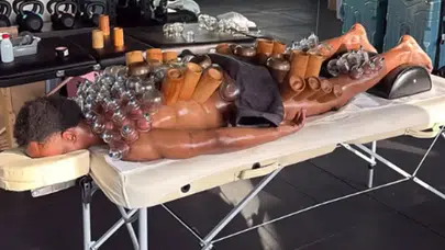 Lois Openda’nın Sırtındaki Kupalar Dikkat Çekti! Hacamat Görüntüleri Paylaşıldı