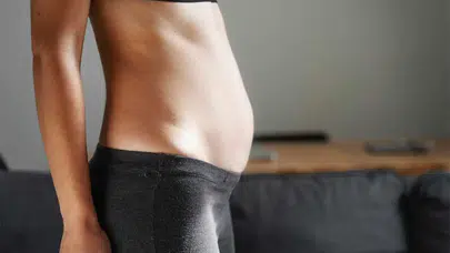 ABDOMİNAL DİSTANSİYON NEDİR? Neden Olur, Belirtileri Nelerdir ve Nasıl Yönetilir?