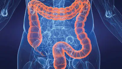 BAĞIRSAK SAĞLIĞINI HANGİ GIDALAR BOZUYOR! Aşırı İşlenmiş Gıdalar ve Katkı Maddeleri Hangi Hastalıkların Riskini Arttırır?