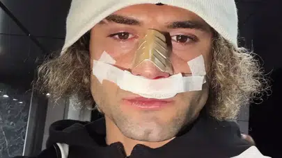 Elazığspor’un Gol Kralı Fuat Bavuk Sahada Sakatlandı! Burnundaki Kırık Maç Sonrası Ortaya Çıktı