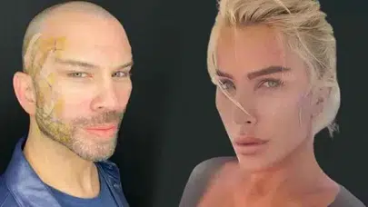 BERKSAN ESKİ HALİ! Berksan estetik yaptırdı mı, şimdi nasıl görünüyor, kaç yaşında?