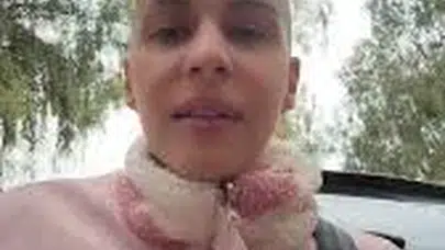 İzmirli Modelin Kanserle Savaşı: Melis Çabas’tan Umut Veren Mesaj!