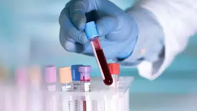 FO2HB DÜŞÜKLÜĞÜ NEDEN OLUR! FO2HB Değeri Düşüklüğü Nedir?