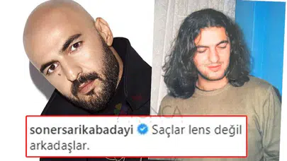 SONER SARIKABADAYI ESKİ HALİ! Saçlı fotoğrafı neden sosyal medyada gündem oldu?
