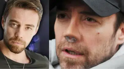 13. ameliyat bitti! Murat Dalkılıç bandajları çıkardı, yeni burnu şoke etti