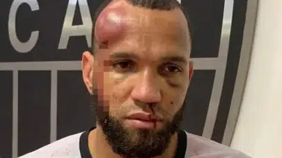 Brezilya’da Olaylı Derbi! Yumruklar Havada Uçuştu, Maç Savaş Alanına Döndü