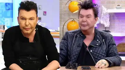 Kuşum Aydın’ın Yüzündeki Büyük Değişim! Ameliyat Sonrası Halini Gören Tanıyamadı