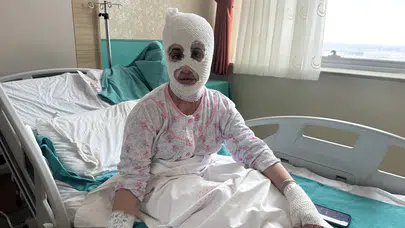 İftar sofrasında dehşet düdüklü tencere patladı, genç kadın yanıklarla hastaneye kaldırıldı