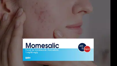 MOMESALİC NEDİR NE İÇİN KULLANILIR? Ne İşe Yarar, Hangi Cilt Hastalıklarında Kullanılır, Yan Etkileri Var mı?