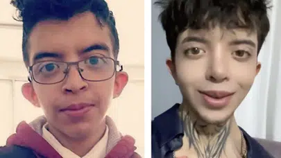 Tablet Reis’in Estetik Sonrası Görünümü Sosyal Medyada Olay Yarattı