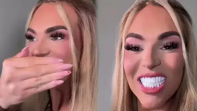 890 Bin TL’lik Diş Estetiği Sosyal Medyayı Karıştırdı! Yorum Yağdı