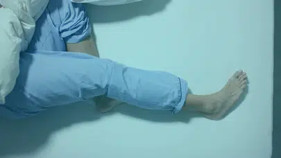Bacaklardaki O Huzursuzluk Sandığınızdan Daha Ciddi Çıkabilir