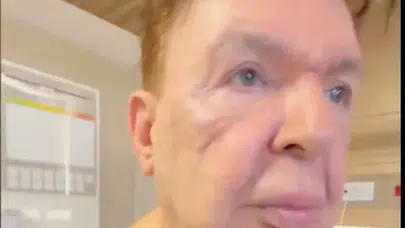 Kuşum Aydın’ın Yüzü Tanınmaz Hale Geldi! Estetikle Baştan Yaratıldı