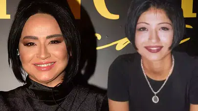 52 Yaşındaki “Abajur Kız”ın İnanılmaz Değişimi