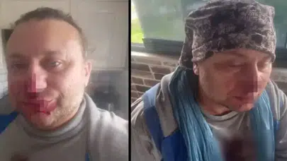 Onur Akay’ın sağlık durumu nasıl, neden entübe edildi, öldü mü?