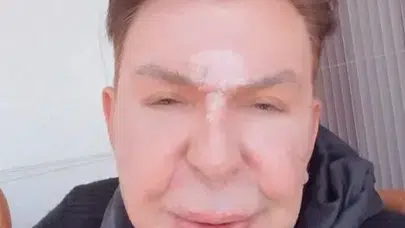 Estetik pişmanlığını bıçak altına yatarak sildi! İşte Kuşum Aydın’ın inanılmaz dönüşümü