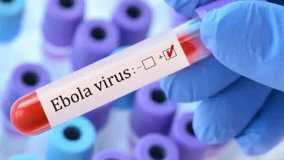 Avrupa’da Ebola kabusu: Fransa’da 5 kişi karantinaya alındı!