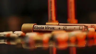 Kongo dönüşü kabus: Fransa'da ilk Ebola vakası kesinleşti!