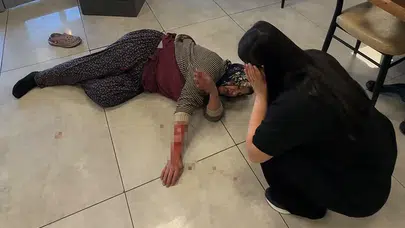 Afyonkarahisar’da dehşet anları: Dinlenme tesisinde kadına köpek saldırısı!