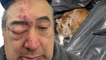 Uyarılara kulak asmadılar, sonu facia oldu: Uyurken yüzünü kemirdiler!