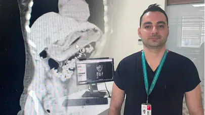 İstanbul'da akılalmaz vaka, zayıflamak isterken midesine 13 santimetrelik diş fırçası kaçırdı, yemek borusu yırtılma riski vardı