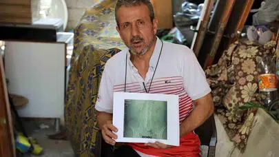 Doktorun unuttuğu parça hayatını bitirdi: Şimdi kimse çıkarmaya yanaşmıyor!