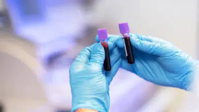 Vazopressin nedir? Erkeklerde nasıl yükselir, ne işe yarar, bilmemiz gerekenler nelerdir, bağ düzeyi nasıl artar?