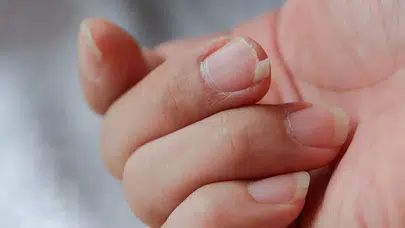 Tırnak kırılması neden olur? Nasıl geçer, doğal tırnak bakımı rutini nedir, kırılan tırnaklar nasıl güçlendirilir?