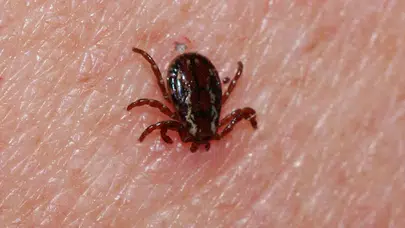 Katil parazit pusuda! kene ısırdığında asla yapmamanız gereken 3 ölümcül hata