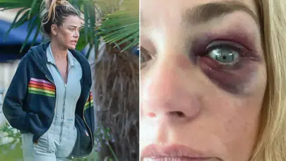 Mutlu yuvası kabusa dönüştü: Hollywood yıldızı evliliğindeki karanlık yüzü anlattı