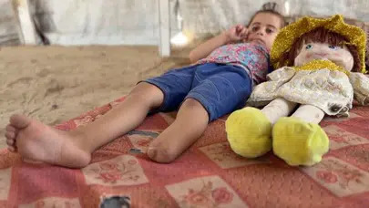 Fotoğraftaki bacağını geri isteyen 4 yaşındaki Cemalat'ın yürek yakan hikayesi