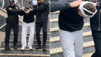 Yüzünü değiştirip 4 milyon dolarla kaçacaktı: Estetik masasında yakalandı!