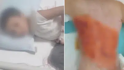 Akran zorbalığı dehşete dönüştü: Oyun dediler, diri diri yaktılar!