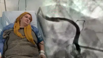 Zatürre kaynaklı şiddetli öksürük kalp damarını yırttı
