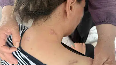 17 bıçak darbesiyle yaşam mücadelesi verdi: Ölü taklidi yaparak katilinden kurtuldu