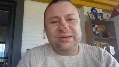Pitbull dehşeti ölümün kıyısına getirdi: Onur Akay yaşadığı kabusu anlattı