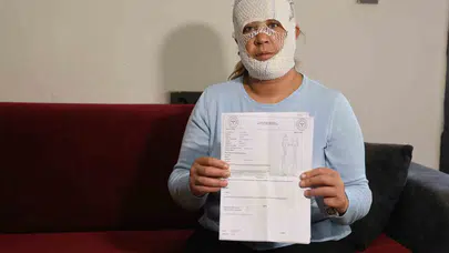Güzellik hayali kabusa döndü: Prenses bakımı yaptırdı, yüzü tanınmaz hale geldi
