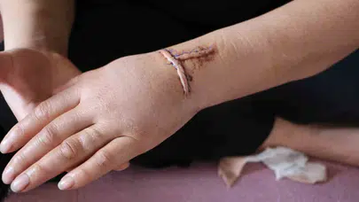 Diyarbakır’da dehşet: 30 yerinden bıçaklanan kadın ölümden döndü, şimdi ise "yarım kalan işi tamamlayacak" korkusuyla yaşıyor