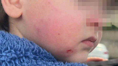 Kreşe bıraktığı çocuğunu darp edilmiş halde aldı