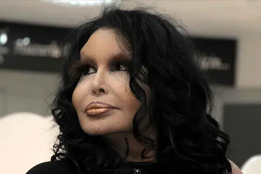 Bülent Ersoy
