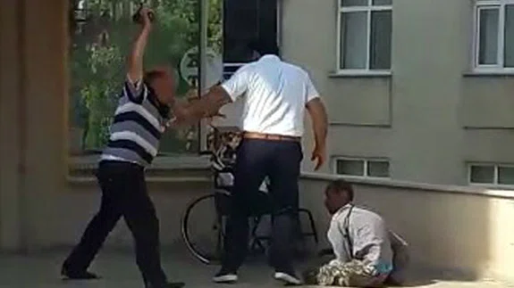 Vicdansız Baba Engelli Oğluna Şiddet Uyguladı