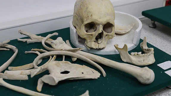 Kovid-19 testi pozitif çıkan şüpheli ölümlerin otopsisi, negatif basınçlı odalarda yapılıyor