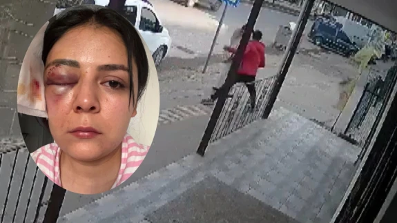 Kahramanmaraş'ta genç kız yolda yürürken yumruklu saldırıya uğradı! İşte o anlar