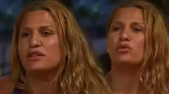 Survivor Almeda Baylan Sakatlandı mı? Almeda’ya ne oldu? Sağlık durumu nasıl, yarışmaya devam edecek mi?