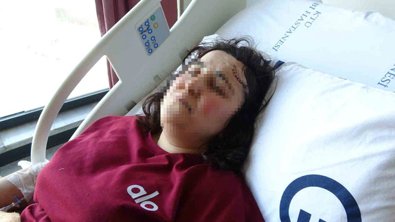 Gümüşhane’de kadına şiddet sokağa taştı: Boşanma aşamasındaki eşi arkadan saldırdı!