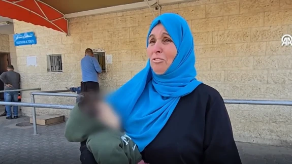 Gazze'de İnsanlık Dramı! 11 Aylık Bebek Beslenme Yetersizliği Nedeniyle Hayatını Kaybetti!