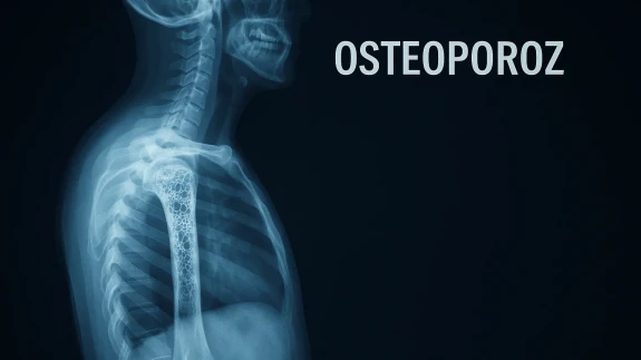 Kemikler Sessizce Çöküyor!