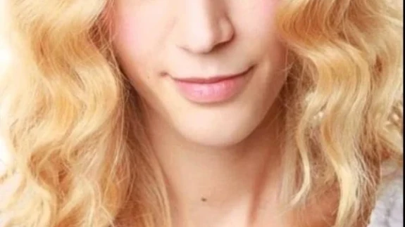 Zeynep Koçak Ameliyat Oldu! "Hastaneye Tek Gitmeyin" Uyarısıyla Gündem Oldu